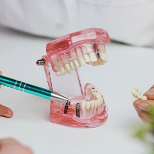 Dentist pointing to model of dental implant