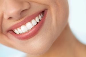 Nose-to-neck view of woman smiling with flawless teeth